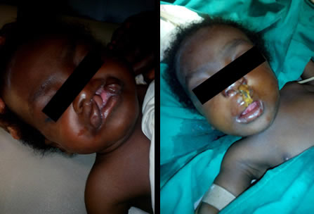 Camp Eden Hospital Gboko, Benue State, Nigeria