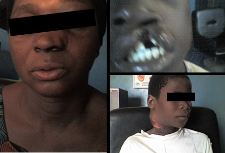 Camp Eden Hospital Gboko, Benue State, Nigeria