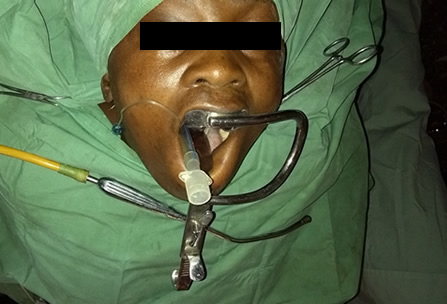 Camp Eden Hospital Gboko, Benue State, Nigeria