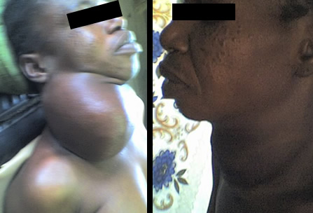 Camp Eden Hospital Gboko, Benue State, Nigeria