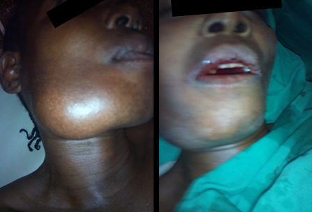 Camp Eden Hospital Gboko, Benue State, Nigeria