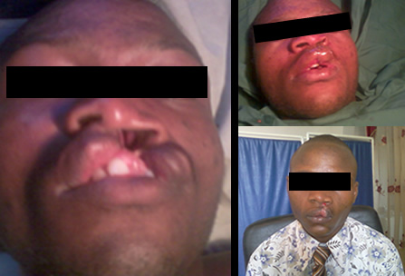 Camp Eden Hospital Gboko, Benue State, Nigeria