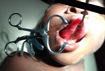 Camp Eden Hospital Gboko, Benue State, Nigeria