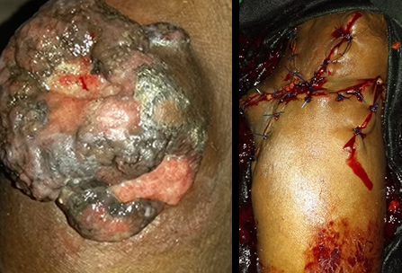 Camp Eden Hospital Gboko, Benue State, Nigeria