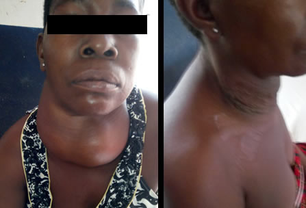 Camp Eden Hospital Gboko, Benue State, Nigeria