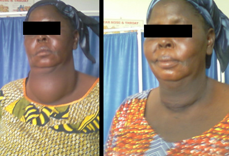 Camp Eden Hospital Gboko, Benue State, Nigeria